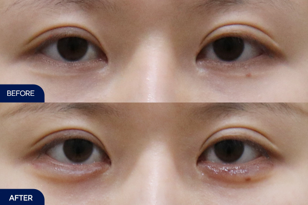 제목