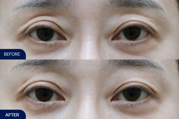 제목