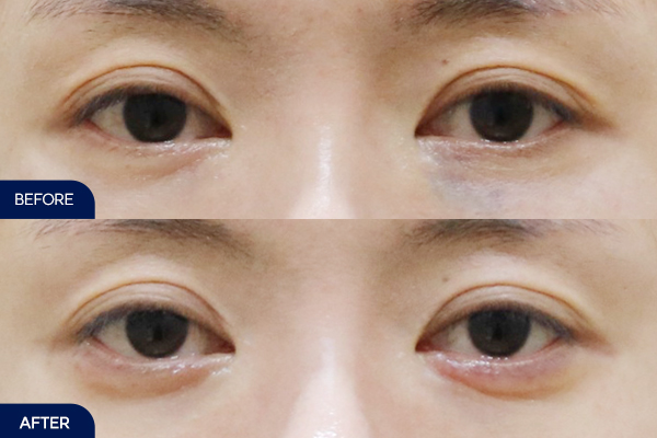 제목