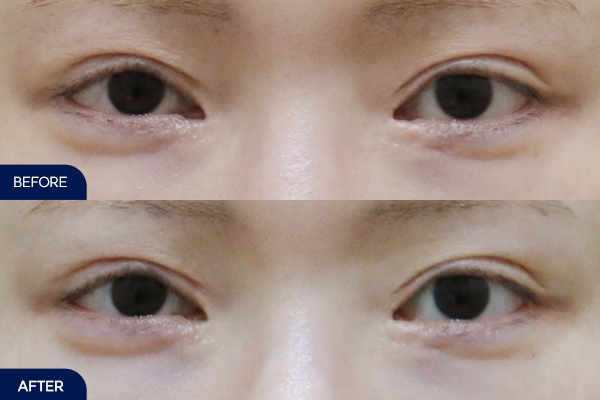 제목