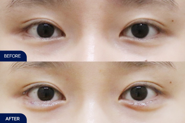 제목