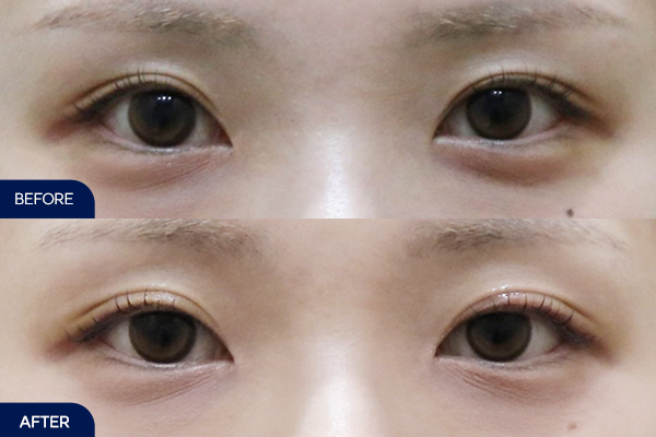 제목