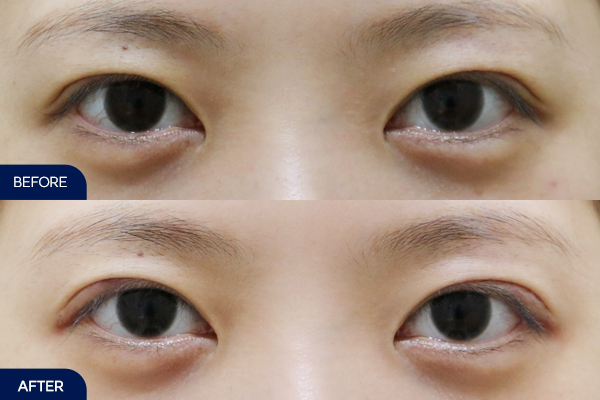 제목