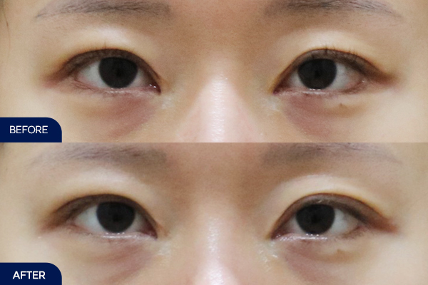 제목