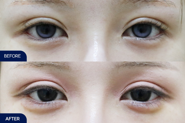 제목