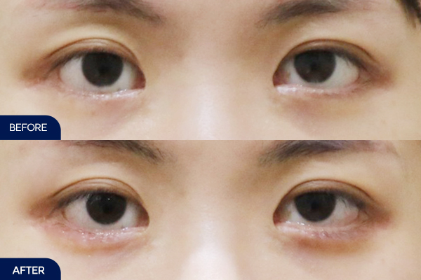 제목