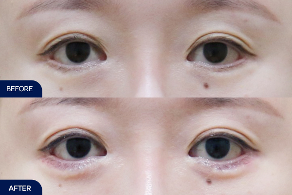 제목