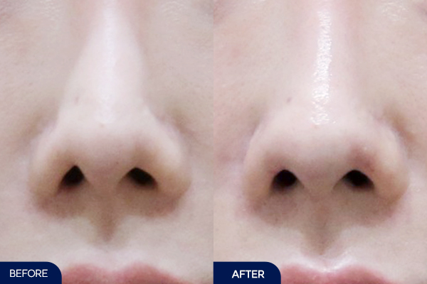 제목