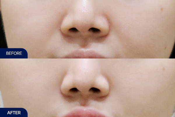 제목