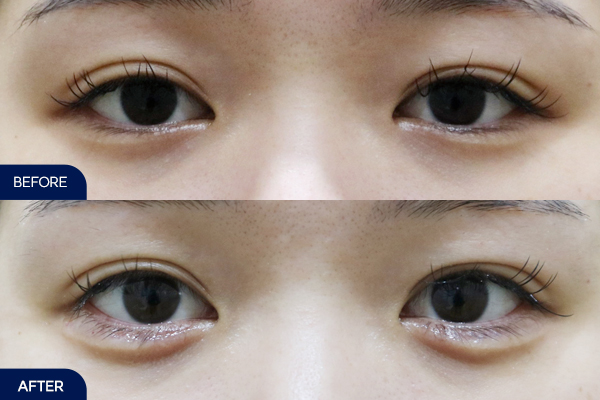 제목
