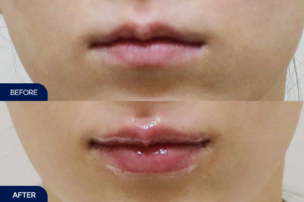 제목