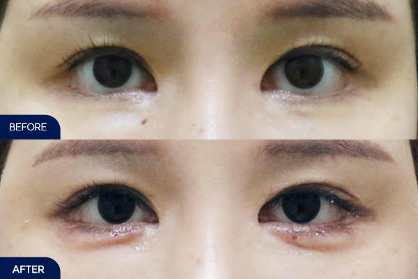 제목