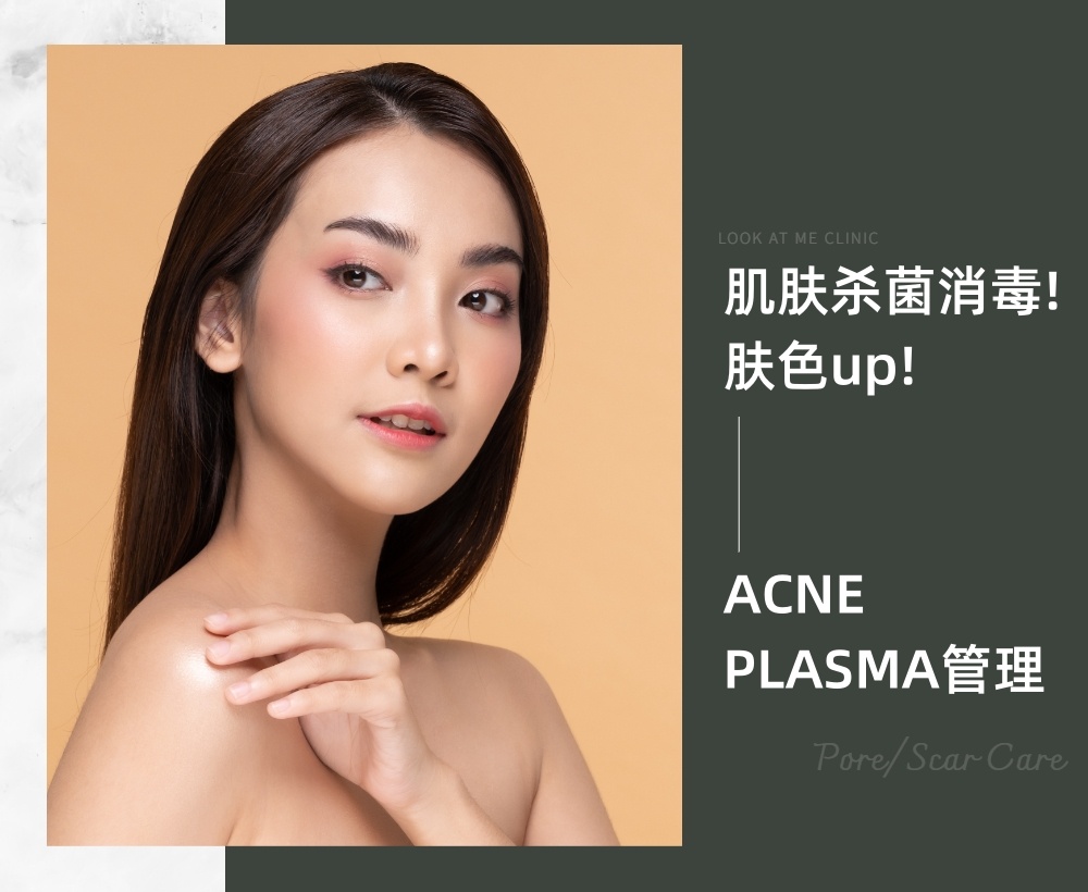 ACNE PLASMA管理