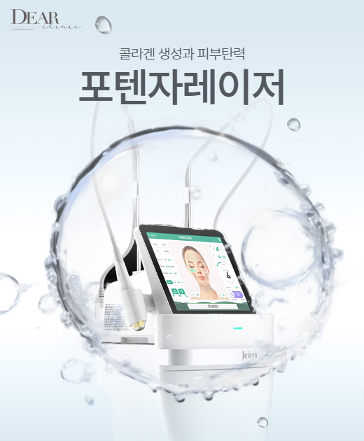 포텐자 레이저